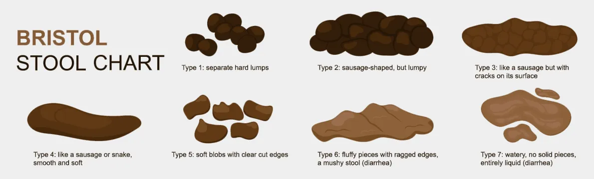 Stool Analysis Chart